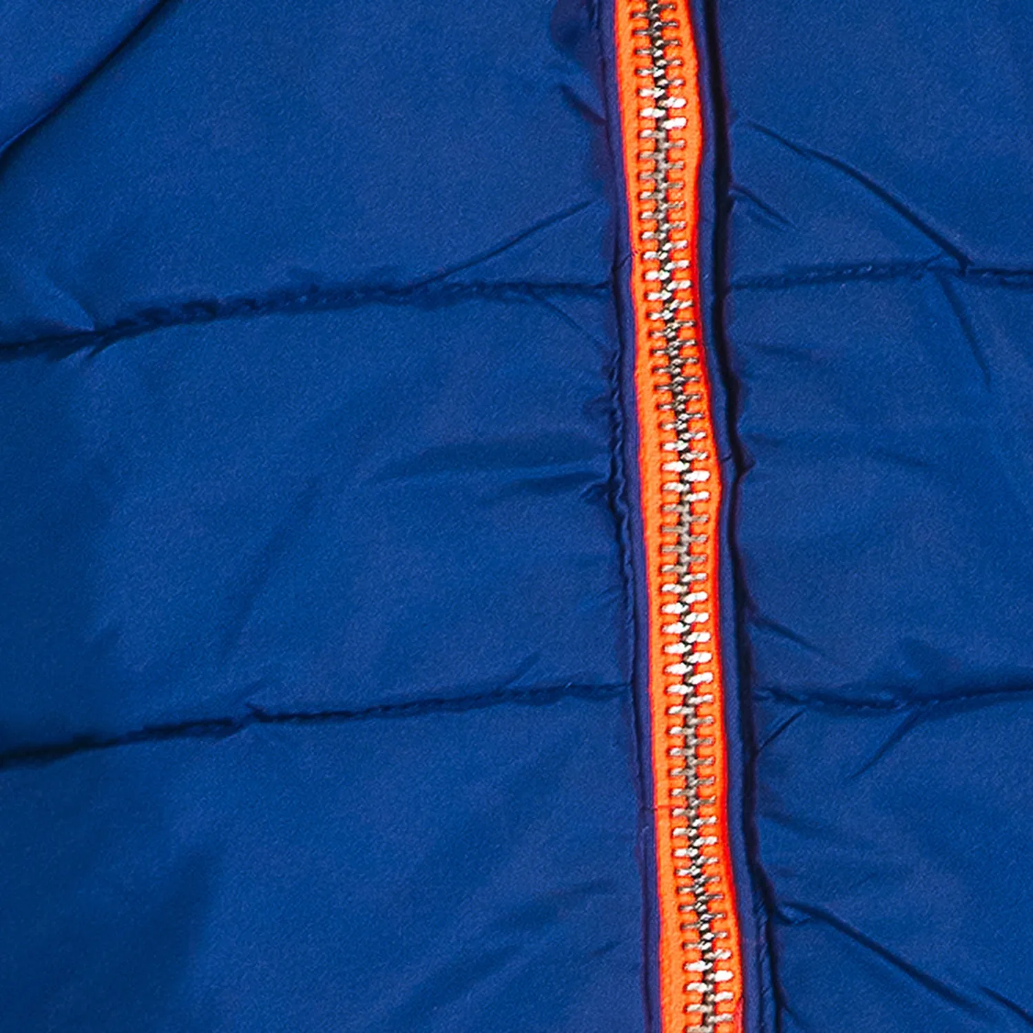 Reversible Bright Jacket